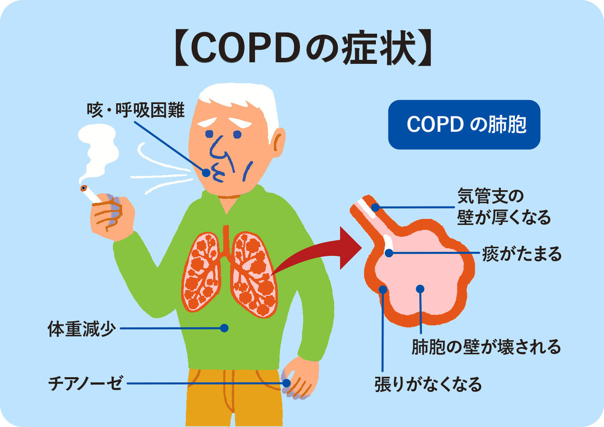 最大の原因は喫煙