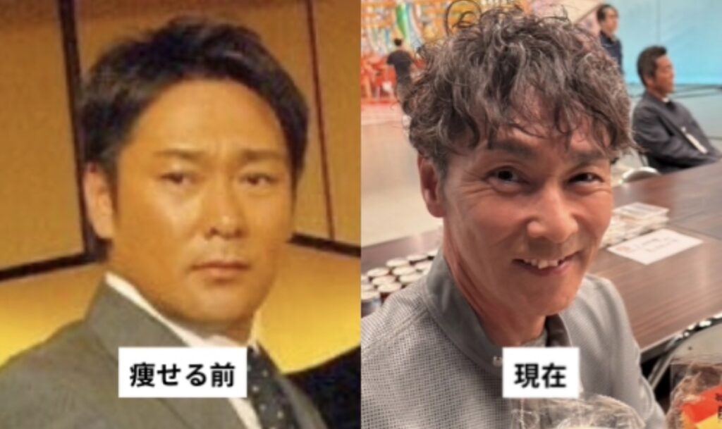 「秘密の痩せ薬（マンジャロやオゼンピックなど）を使っているのではないか」